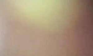 Ева Брайън Хан има един клипове на порно в аналната област в гипс.